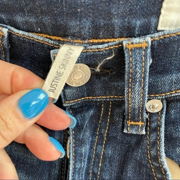 NWOT Rag‎ & Bone Justine Highrise Skinny Distressed Raw Hem Women's Size 24 - Picture 7 of 10